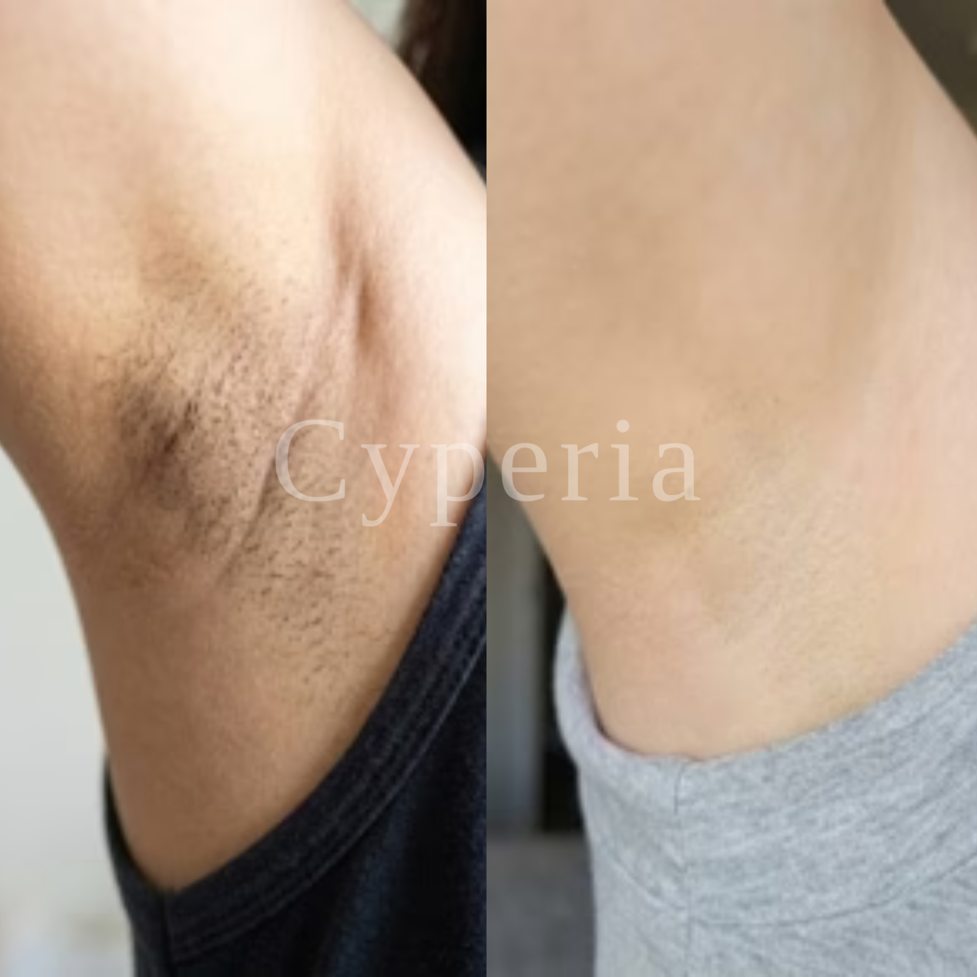 Siero Botanico Anti-Ricrescita